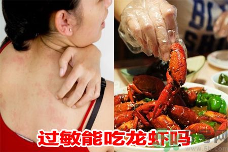 過(guò)敏能吃龍蝦嗎?吃龍蝦會(huì)過(guò)敏嗎?