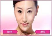 美白針真的有效嗎？美白針的危害有哪些？