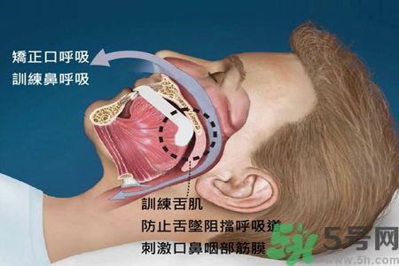 耳鳴是什么原因引起的？耳鳴怎么治療最好？