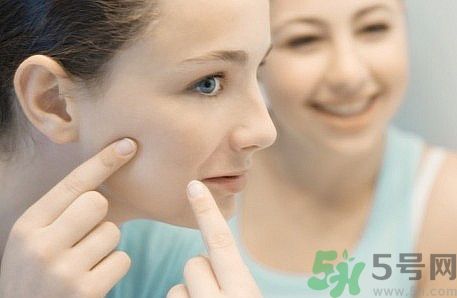 臉上有痘印怎么去除？去除痘印的小妙方？
