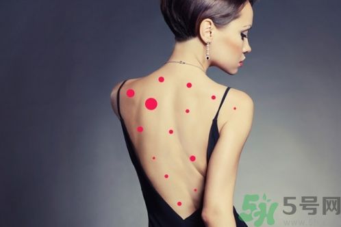 背上為什么會(huì)長(zhǎng)痘痘？長(zhǎng)痘痘怎么辦？