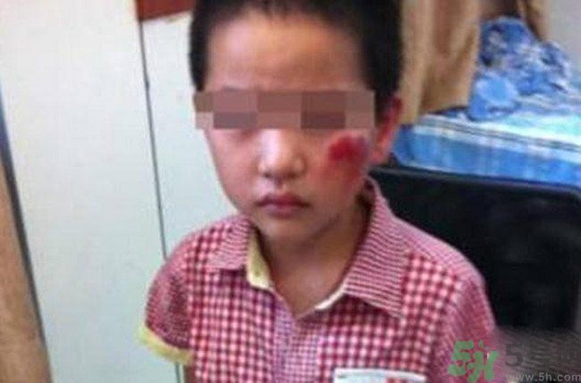 男孩遭校長暴打的結(jié)果是什么？男孩遭校長暴打的真相是什么？