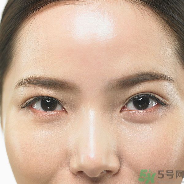 眉周紋是怎么形成的？眉周紋怎么去除？