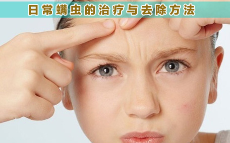 除螨噴霧哪個(gè)牌子好 除螨噴霧十大品牌