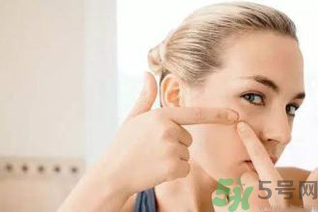 一到夏天呢長(zhǎng)痘痘怎么回事？夏天長(zhǎng)痘痘怎么辦？