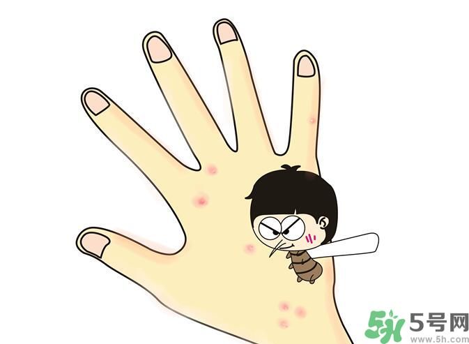蚊子叮的包過幾天又癢是為什么？蚊子叮的包過幾天又癢怎么辦？