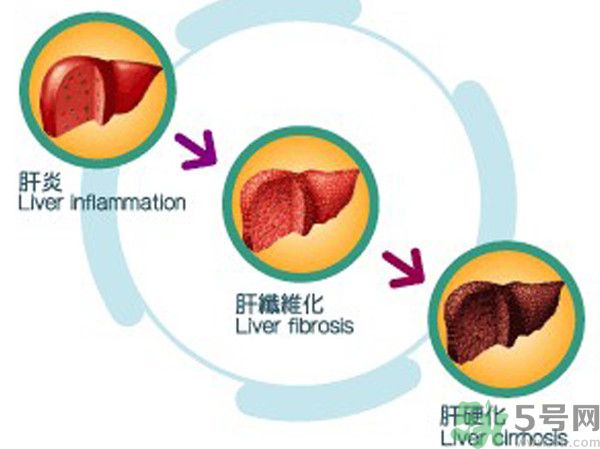 在外面吃飯會(huì)得乙肝嗎？在食堂吃飯會(huì)得乙肝嗎？
