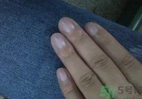 指甲發(fā)紫是什么原因？指甲發(fā)紫是怎么回事？