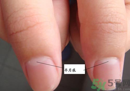 指甲沒有月牙是什么原因？指甲沒有月牙怎么調(diào)理？