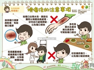手被油燙傷了怎么處理？手被油燙起泡了怎么辦？