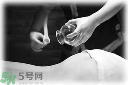 大暑可以拔罐嗎？大暑拔罐好不好？