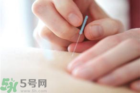 大暑可以針灸嗎？大暑針灸好不好？