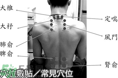經(jīng)期可以貼三伏貼嗎？來(lái)月經(jīng)可以貼三伏貼嗎？