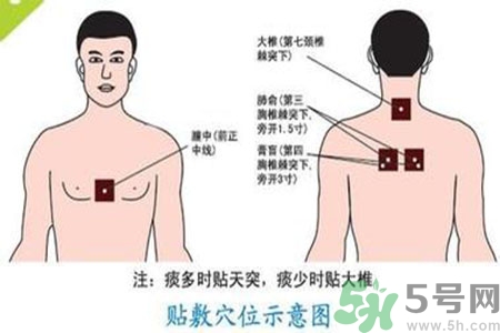 三伏貼能治頸椎病嗎？頸椎病三伏貼穴位