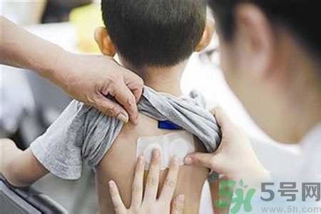 三伏貼能治頸椎病嗎？頸椎病三伏貼穴位