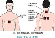 腰痛貼三伏貼有用嗎？腰痛三伏貼貼哪個(gè)穴位？