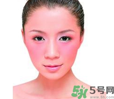 敏感性皮膚用什么洗面奶？敏感性皮膚怎么修復(fù)？