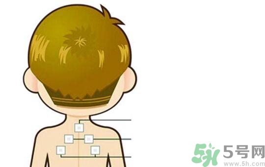 貼三伏貼可以吹空調(diào)嗎？貼完三伏貼多久后可以吹空調(diào)？
