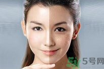 干性皮膚用什么洗面奶？干性皮膚該怎么保養(yǎng)？