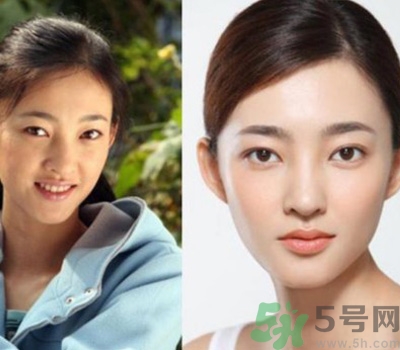 開眼角眼睛會變大嗎？開眼角眼睛能大多少？