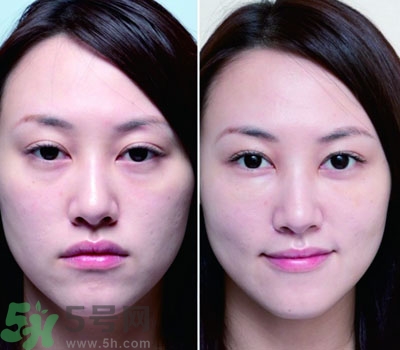 臥蠶是什么？臥蠶是眼袋嗎？