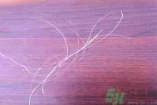 生完寶寶白頭發(fā)的原因？生完寶寶白頭發(fā)怎么辦？