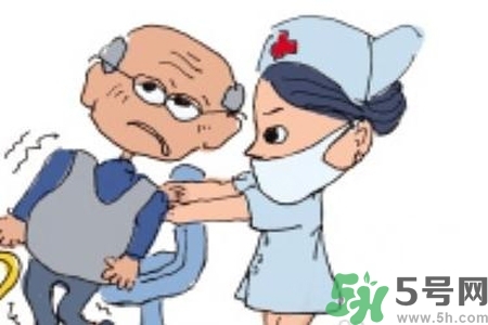 癲癇的典型癥狀有哪些？癲癇是什么？