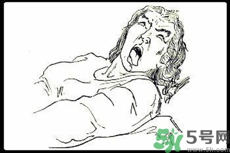 癲癇的護理措施？癲癇的飲食護理是什么？
