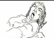 癲癇的發(fā)病因素？癲癇的并發(fā)癥有哪些？