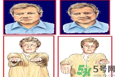 腦中風(fēng)是什么？腦中風(fēng)的癥狀？