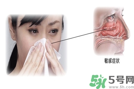 過(guò)敏性鼻炎的高發(fā)人群有哪些？如何預(yù)防過(guò)敏性鼻炎？