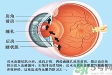 青光眼是什么？青光眼癥狀有什么？
