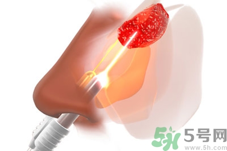 鼻咽癌的日常措施是什么？鼻咽癌注意的飲食有哪些？
