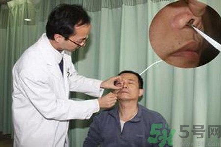 鼻咽癌的治療方法是什么？鼻咽癌可以用什么藥物治療？