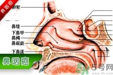 鼻咽癌的發(fā)病因素是什么？鼻咽癌的并發(fā)癥有哪些？