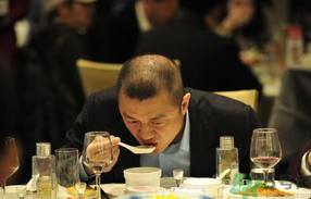 男人禿頂會(huì)遺傳嗎？男人禿頂是腎虛嗎？