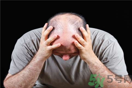 脫發(fā)的治療方法是什么？脫發(fā)的藥物治療有哪些？