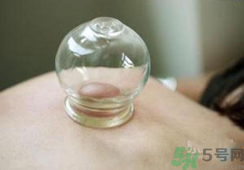 拔火罐和拔氣罐哪個(gè)好？拔火罐和拔氣罐的區(qū)別