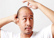 脫發(fā)的高發(fā)人群有哪些？如何預(yù)防脫發(fā)？