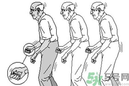 帕金森要注意哪些措施？帕金森的飲食需注意什么？