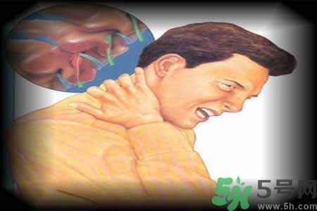 為什么年輕人容易得頸椎病？頸椎病嚴(yán)重的癥狀有哪些？