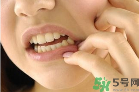 天熱牙疼要注意什么？天熱牙疼什么原因？