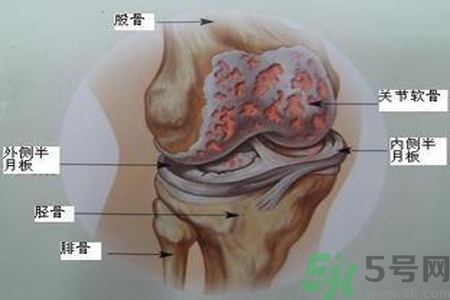 預(yù)防骨病需要注意哪些姿勢(shì)？秋季預(yù)防骨病的方法有哪些？