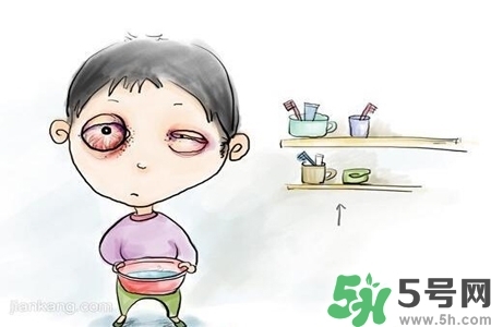寶寶為什么會感染紅眼??？寶寶患紅眼病如何治療？