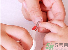 寶寶長(zhǎng)蘚是怎么回事？寶寶長(zhǎng)蘚怎么辦？