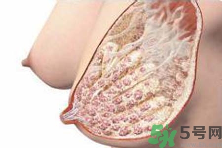 乳腺增生治療方法是什么？乳腺增生的檢查方法有哪些？