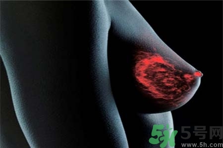 乳腺增生治療方法是什么？乳腺增生的檢查方法有哪些？