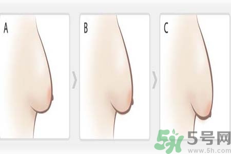 胸部松弛的原因是什么？胸部松弛該怎么辦？