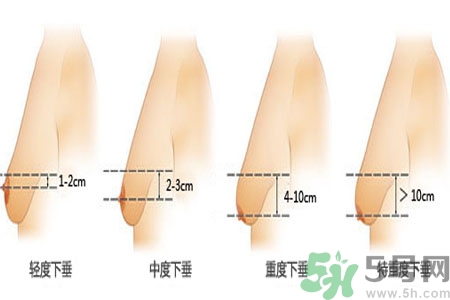 胸部松弛的原因是什么？胸部松弛該怎么辦？