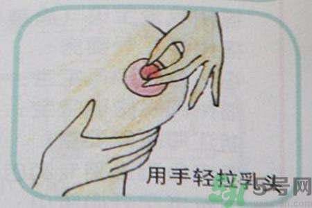 乳頭內(nèi)陷怎么回事？乳頭內(nèi)陷的原因是什么？